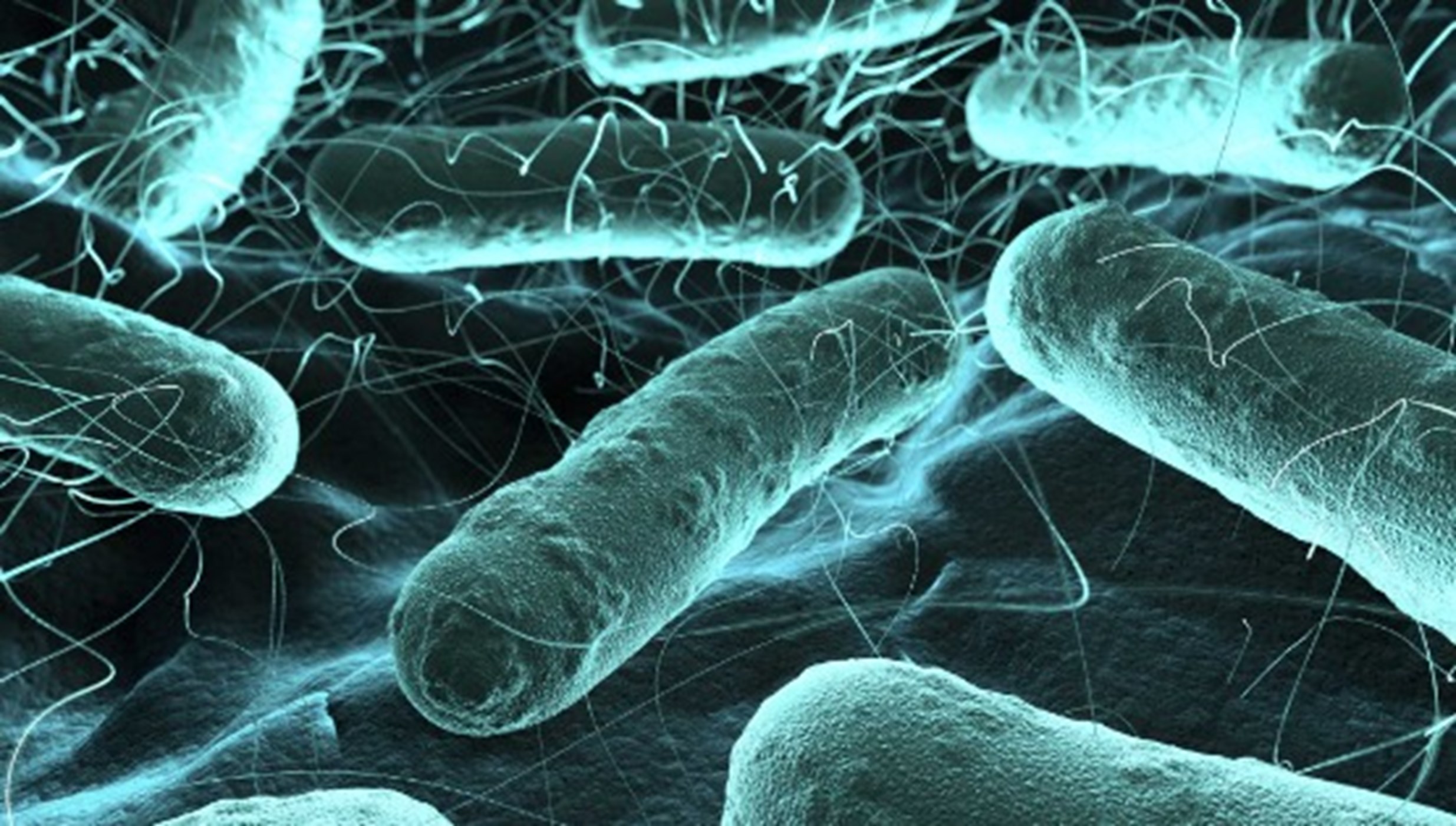 legionella legionella